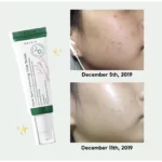 سرم روشن‌ کننده و ضد لک اکسیس وای AXIS-Y حجم 50 میل