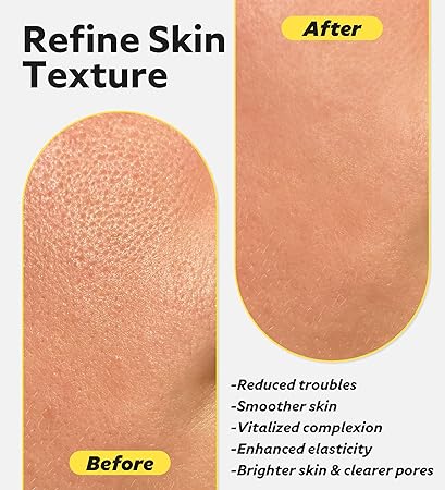 سرم قابض منافذ و کنترل کننده چربی تیام