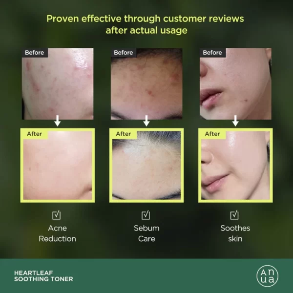 تونر آبرسان آنوا Anua حجم 250 میل