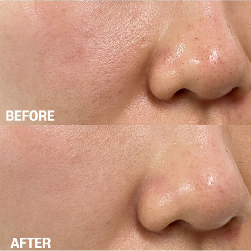 سرم قابض منافذ و کنترل کننده چربی تیام